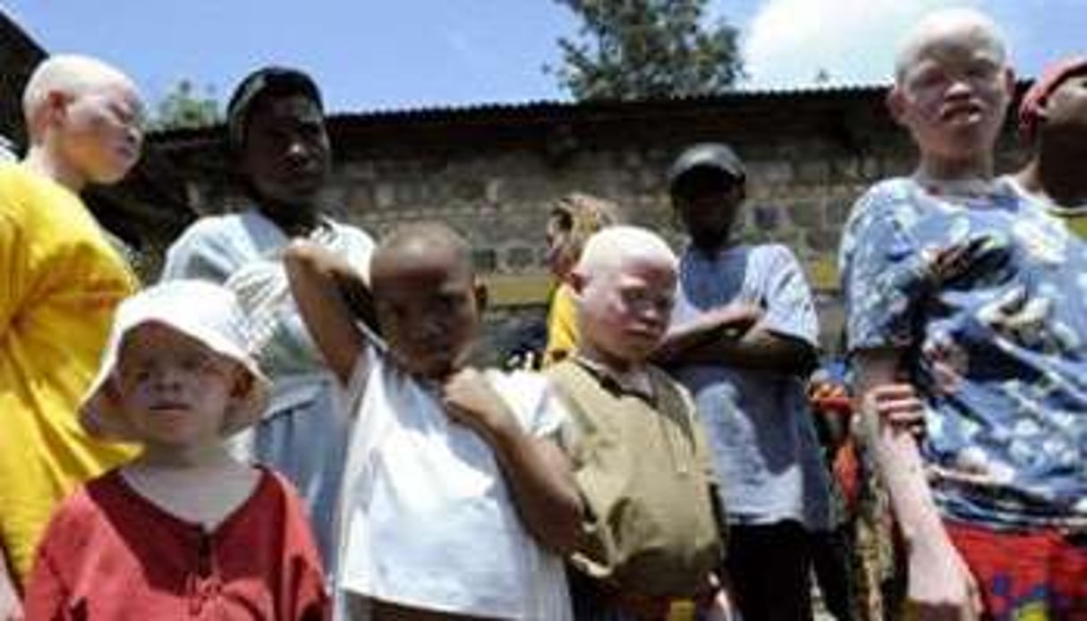 Des enfants de la « Maison des Albinos » dans une province burundaise frontalière de la Tanzanie. © Stéphane de Sakutin/AFP