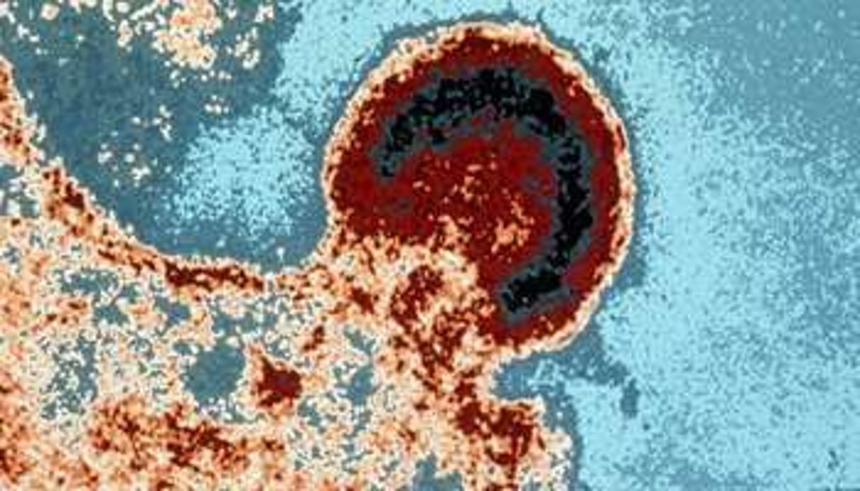 Le virus du sida fixé sur un lymphocyte, vu sous un microscope de l’Institut Pasteur en 2001. © AFP