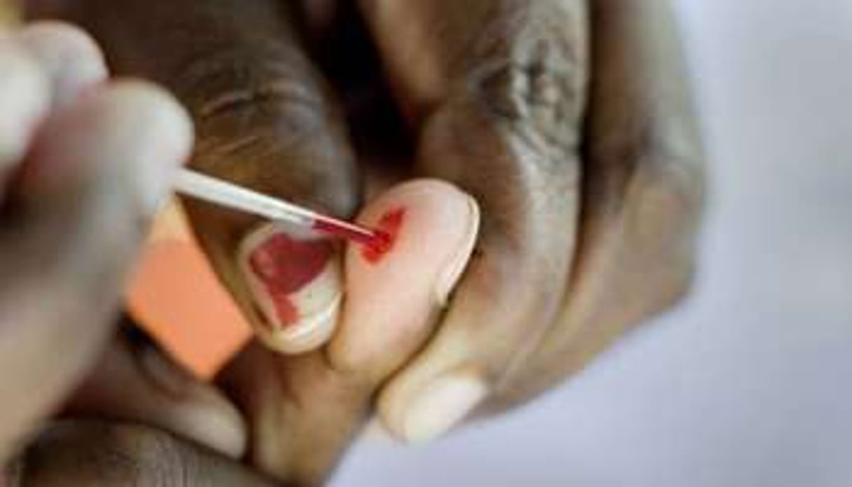 Test de dépistage du sida en Afrique du Sud. © AFP