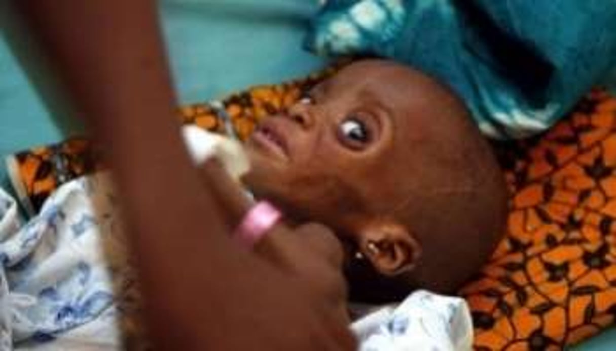 Une petite fille d’un an souffrant de paludisme au Liberia en juillet 2003. © Georges Gobet/AFP