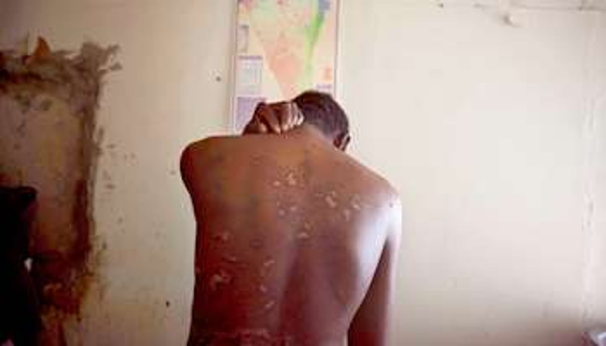Les séquelles de tortures et les témoignanges de migrants subsahariens se multiplient. © Oded Balilty/AP/SIPA
