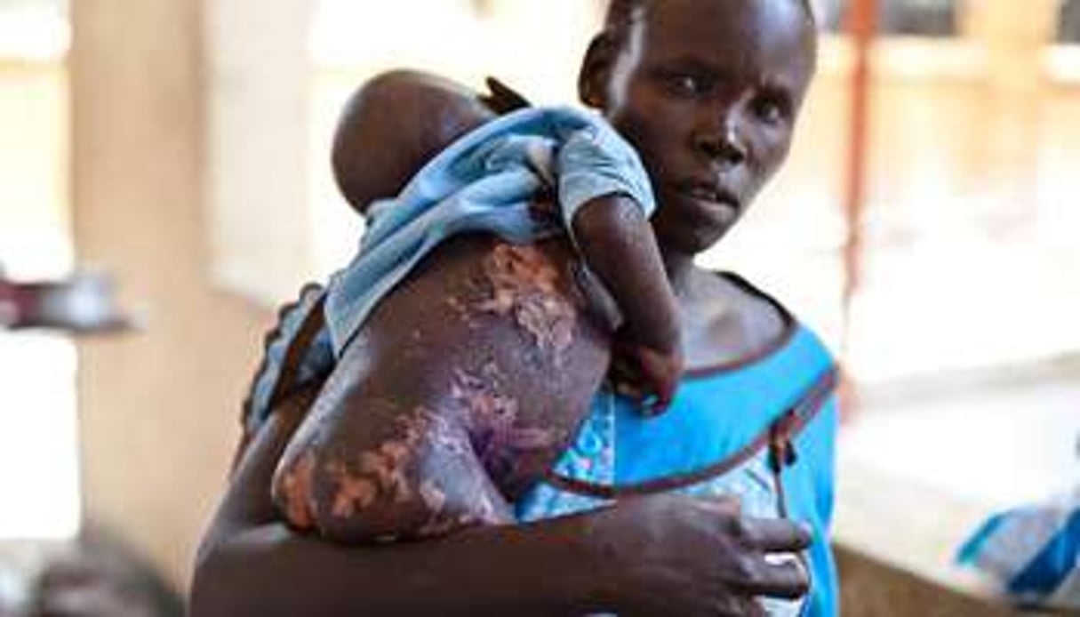 Une Soudanaise et son enfant souffrant de malnutrition à Juba, le 14 mars 2014. © Ivan Lieman