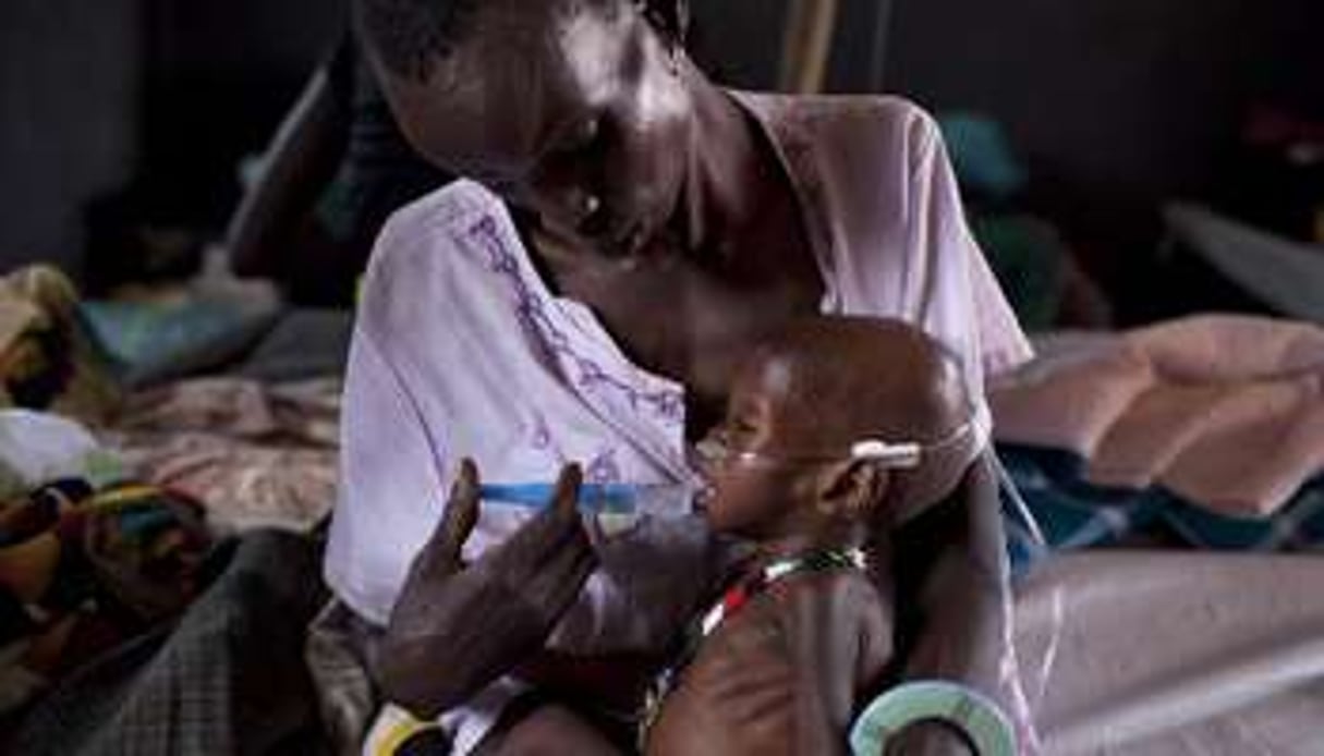 Un enfant malnutri, le 3 mars 2014 à Minkamman (Soudan du Sud). © AFP