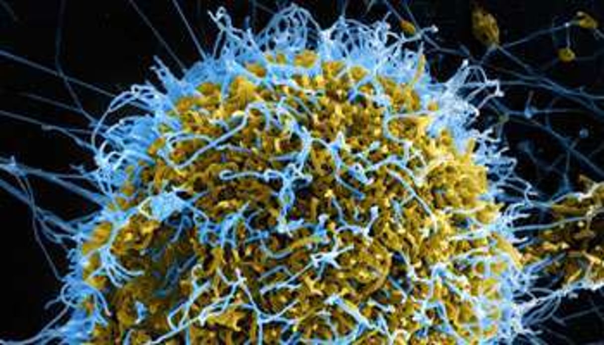 Une cellule atteinte par le virus Ebola, vue au microscope. © NIAID / BSIP / AFP