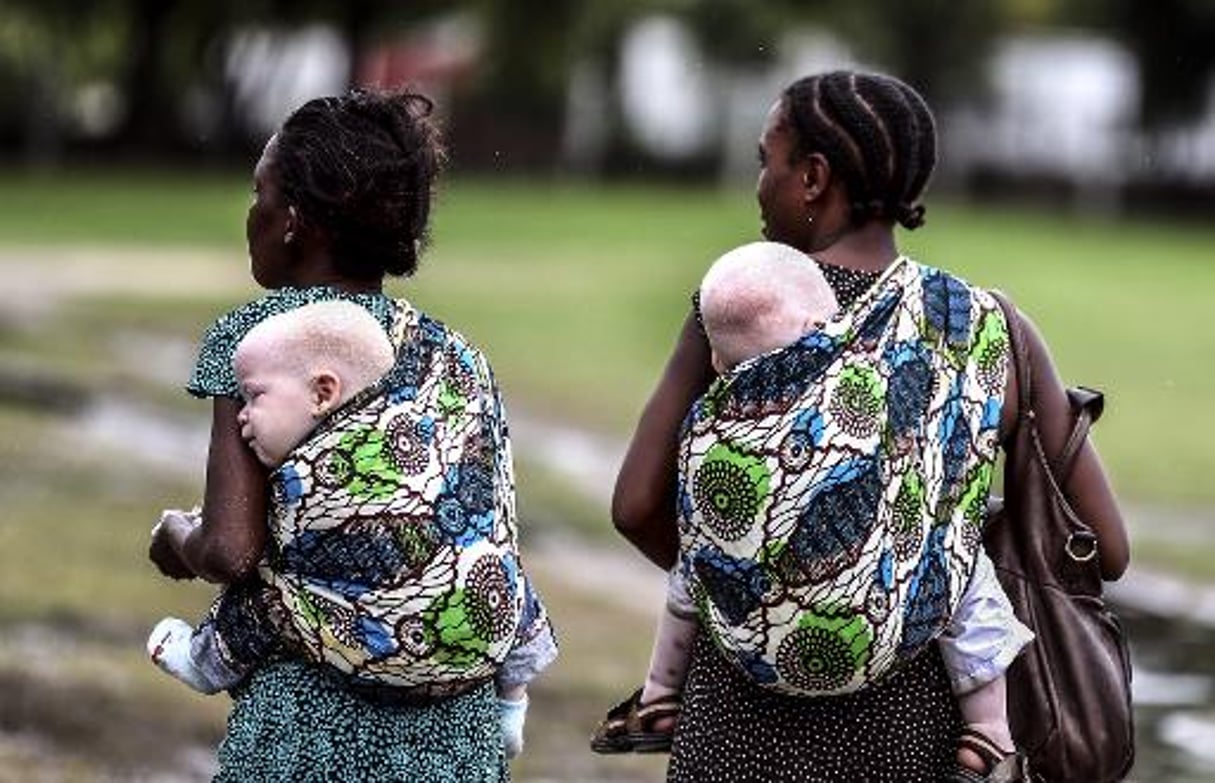 La Tanzanie interdit la sorcellerie pour protéger les albinos © AFP