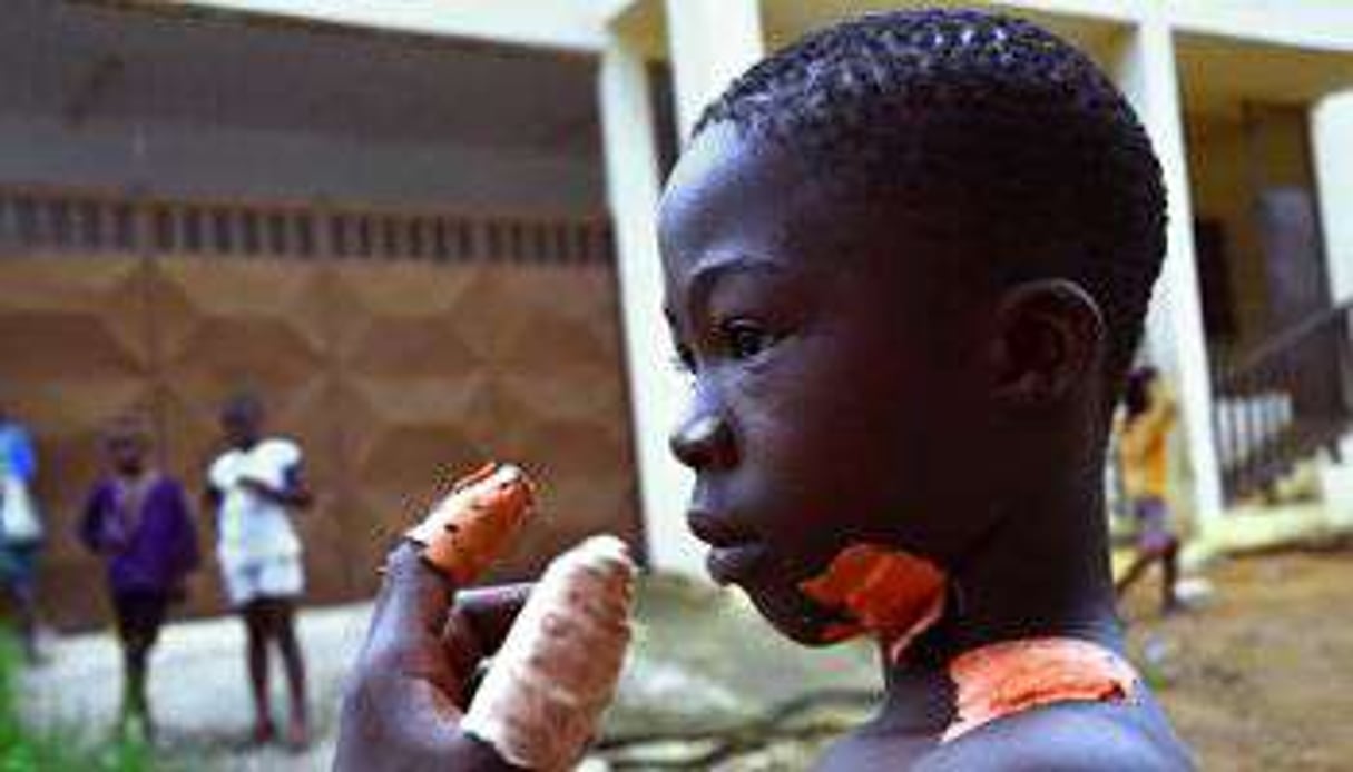 Souleymane, un garçon de 10 ans qui a survécu à une agression dans le quartier de Yopougon, à Ab © AFP