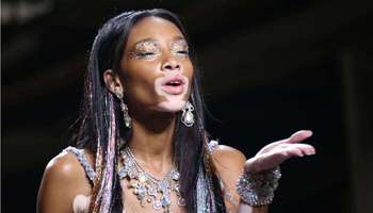 Chantelle Brown-Young, connue sous le nom de Winnie Harlow, à Londres, le 16 septembre 2014. © Joel Ryan/Invision/AP/AP/SIPA