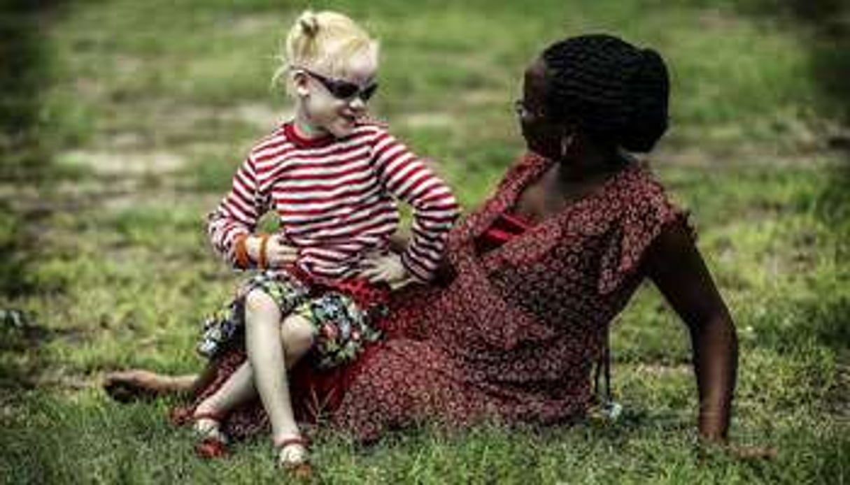 Une mère tanzanienne et sa fille albinos. © Bunyamin Aygun/AFP