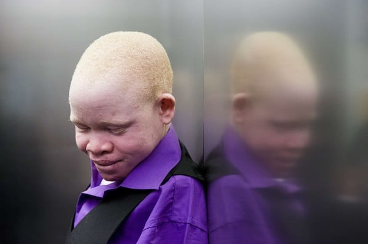 Un enfant albinos de Tanzanie. © Matt Rourke/AP/SIPA