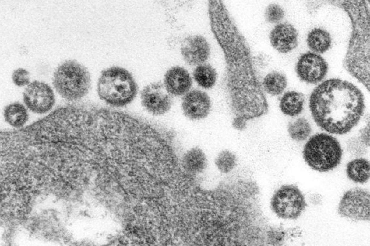 Microscopie électronique du virus de Lassa. © AFP