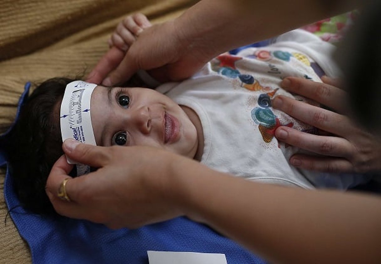 Les autorités brésiliennes mesurent le crâne d’un enfant de trois mois dans le cadre d’études pour déterminer le lien entre Zika et la microcéphalie. © Andre Penner/AP/SIPA