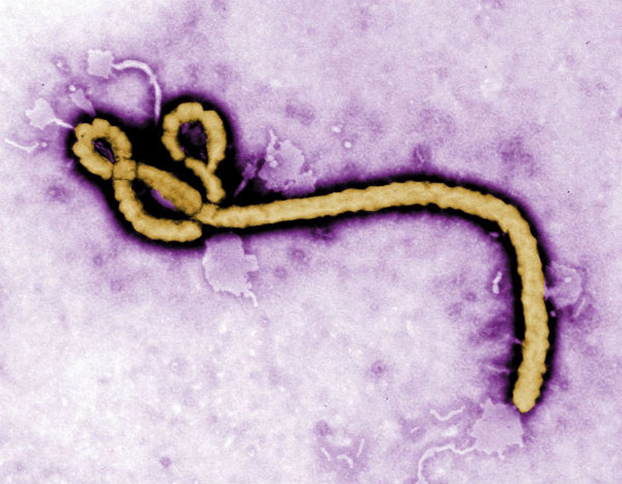 Une micrographie de la souche du virus Ebola. © Frederick Murphy/AP/SIPA