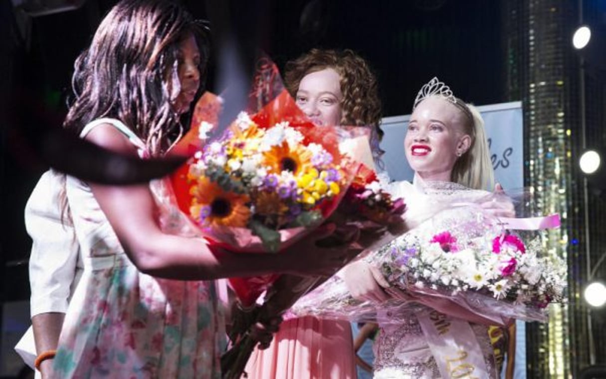 Sithembiso Mutukura, une étudiante de 22 ans, a remporté le concours de Miss Albinos vendredi à Harare (Zimbabwe). © AFP/Jekesai NJIKIZANA.