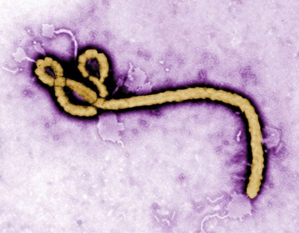 Un virion de la fièvre hémorragique Ebola. © Frederick Murphy/AP/SIPA