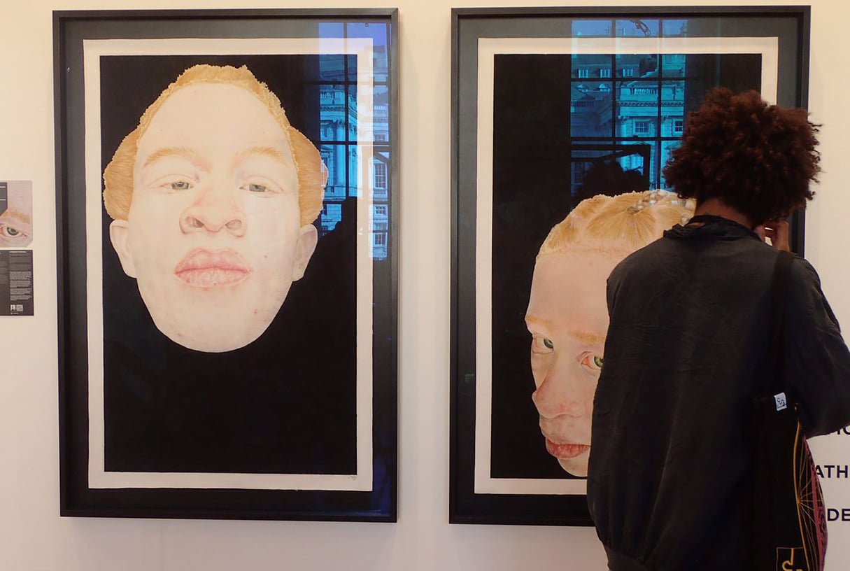 Portraits d’albinos de la Sud-Africaine Athenkosi Kwinana, à la foire 1-54, à Londres, en octobre 2022. &copy; Nicolas Michel