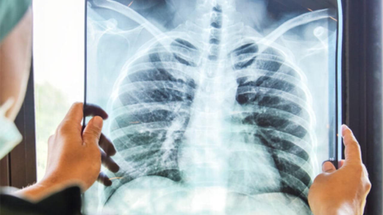 Maroc : l’intelligence artificielle au chevet d’un système de santé en transition