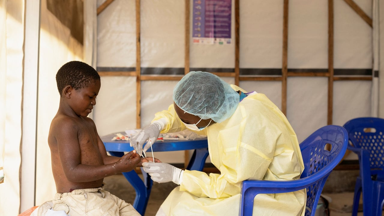 Mpox: l’agenzia sanitaria dell’Unione africana lancia il massimo livello di allerta