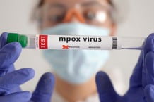 Éprouvette de test étiquetée « Mpox virus positive » © Dado Ruvic/REUTERS