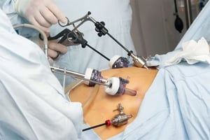 La victime, 27 ans, est décédée après avoir subi une sleeve gastrique, une opération de chirurgie bariatrique visant à réduire le volume de l’estomac afin de favoriser une perte de poids. © DR
