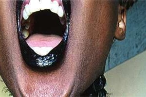 Screamblacklips, de Nontsikelelo Veleko. © Nontsikelelo Veleko.