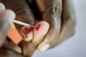 Test de dépistage du sida en Afrique du Sud. © AFP