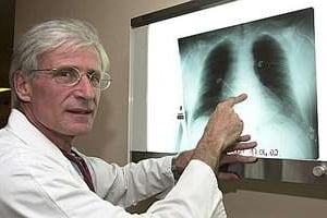 Un médecin analyse des radios pulmonaires. © AFP