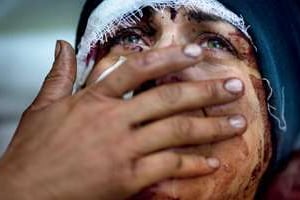 Cette Syrienne grièvement blessée a perdu son mari et deux de ses enfants. © Rodrigo Abd/SIPA