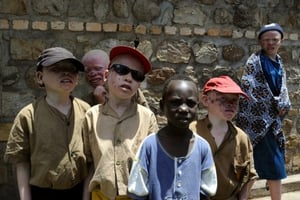 Swaziland: les Albinos dans la peur des crimes superstitieux avant les élections © AFP