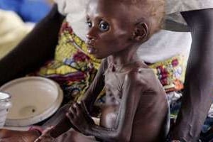 Cette année, 505 976 cas de malnutrition ont été traités par les structures publiques du Niger. © AFP/Issouf Sanogo