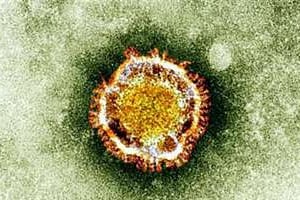 Photo non datée montrant le coronavirus vu sous microscope électronique. © AFP