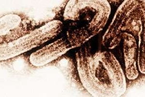 Le virus Ebola au microscope. © AFP