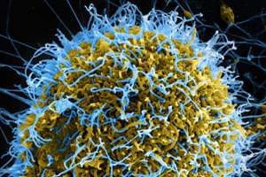 Une cellule atteinte par le virus Ebola, vue au microscope. © NIAID / BSIP / AFP