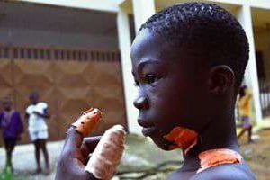 Souleymane, un garçon de 10 ans qui a survécu à une agression dans le quartier de Yopougon, à Ab © AFP