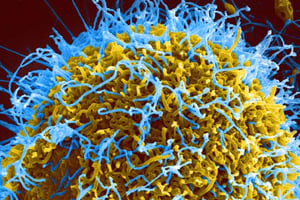 Micrographie électronique de particules de virus Ebola (filaments bleus) sur une cellule infectée. © NIAID / CC BY 2.0