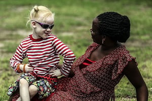 Un Tanzanien sur 1400 environ est atteint d’albinisme à des degrés divers. © AFP