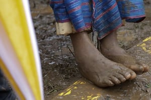 Selon l’Unicef, 200 millions de jeunes filles et de femmes vivant aujourd’hui ont déjà été victimes de mutilations sexuelles. © Andrew Medichini / AP / SIPA