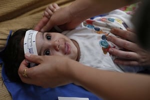 Les autorités brésiliennes mesurent le crâne d’un enfant de trois mois dans le cadre d’études pour déterminer le lien entre Zika et la microcéphalie. © Andre Penner/AP/SIPA