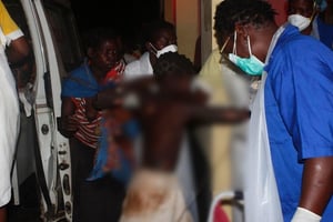 Un enfant grièvement brûlé pris en charge à l’hôpital de Tete, à 90 km du lieu de l’accident le 17 novembre 2016. © AFP/Amos Zacarias