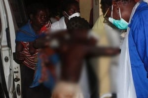 Un enfant grièvement brûlé pris en charge à l’hôpital de Tete, à 90 km du lieu de l’accident le 17 novembre 2016. © AFP/Amos Zacarias