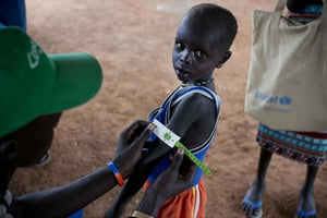 Au Soudan du Sud, un humanitaire mesure le bras de ce jeune garçon afin de savoir s’il souffre de malnutrition. © Kate Holt/AP/SIPA