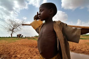 La prévalence de la malnutrition aiguë globale des enfants au sud-est du Niger inquiète l’UEMOA. © GEORGE OSODI/AP/SIPA