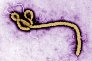 Une micrographie de la souche du virus Ebola. © Frederick Murphy/AP/SIPA