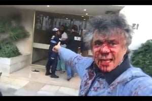 Rachid Nakkaz quelques minutes après l’agression, filme l’arrestation de son agresseur présumé, devant la maison de Amar Saâdani à Neuilly-sur-Seine. © Capture d’écran de la vidéo Facebook de la page « 1.2.3 viva l’Algérie ».