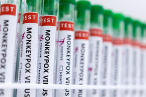 Tests de dépistage de la variole du singe. © Dado Ruvic/REUTERS