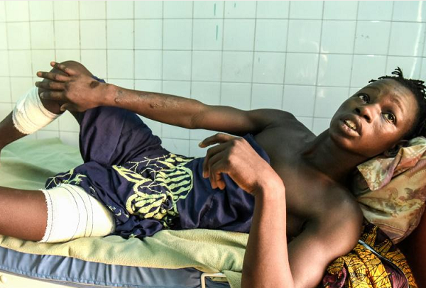 Ali Fall, un jeune pêcheur sénégalais sur son lit à l'hôpital de Gouloumbou, montre ses bandages aux jambes, le 12 mai 2016. &copy; Seyllou/AFP